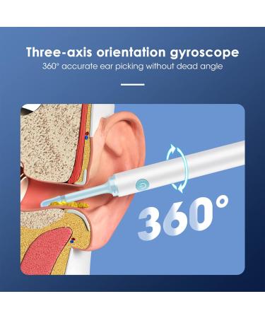 Earify Ear Wax Removal Kit with Camera and Light - Ear Wax Cleaner for Adults & Kids (White) - Buy Online on SooperMarket.com
