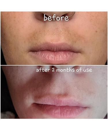 Dark Spot Corrector & Brightening Serum with Kojic Acid, Vitamin C, Salicylic Acid & More | Melasma Treatment Cream by Admire My Skin - Buy Online on SooperMarket.com