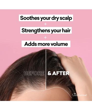 Natural Hair Regrowth Oil for Men and Women - Just Nutritive 4 Oz - Buy Online on SooperMarket.com