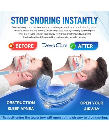 Mouth Guard For Sleep Snoring Solution - Snoring Mouthpiece For Quiet Sleep - Reusable Mouth Guard For Stop Snoring - Help Men/Women for Their Sleep Breathe Better - V Flow Design - 1mm - 4mm - Buy Online on SooperMarket.com
