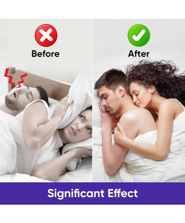 100Pcs Nasal Strips for Snoring - Anti Snoring Solution for Comfortable Sleep - Buy Online on SooperMarket.com