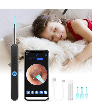 Ear Wax Removal Tool Camera, Ear Cleaning kit Smart Visual Ear Cleaner,1296P Wireless Ear Otoscope, Ear Scope with Ear Wax Cleaner Tool for Babies Kids Adults Pets