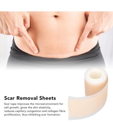 Self-Adhesive Reusable Scar Tape Roll for Postpartum Recovery | Scar Gel Tape - Buy Online on SooperMarket.com