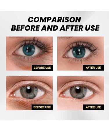 Temporary Eye Tightener Eye Cream Instant Firming Eye Cream Anti Wrinkle Eye Cream Deep Hydrating Eye Cream for Dark Circles and Puffy Eyes Eye Bag Remover Dark Circle Eye Skincare Men & Women Use - Buy Online on SooperMarket.com
