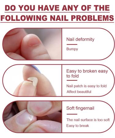 Instant Nail Repair Gel - Nail Glue for Cracked and Split Nails - Nail Treatment Kit - 20g with Brush - Buy Online on SooperMarket.com