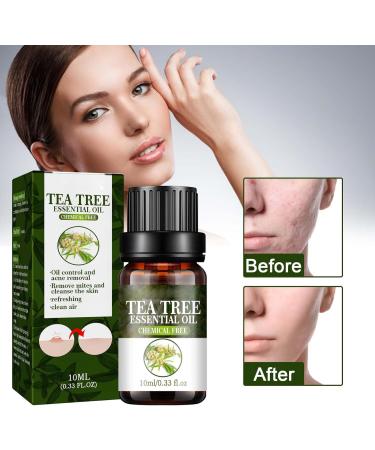 Trendyfave Tea Tree Essential Oils Tea Tree Oil for Skin Anti-Pimples and Acne Moisturizer and Brighten Skin. Tea Tree Oil for Diffuser Humidifier DIY Home Office. Tea Tree Face Oil-10ml - Buy Online on SooperMarket.com