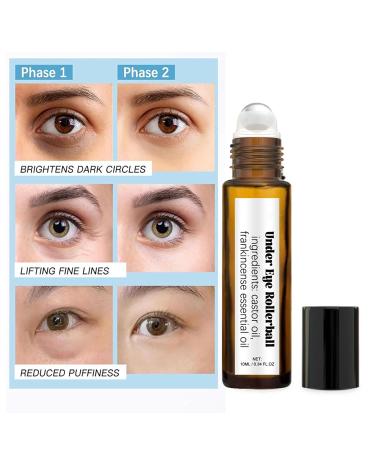 Rollerball Castor Oil & Frankincense Eye Roller | Reduce Dark Circles & Bags Under Eyes - International Shipping - Buy Online on SooperMarket.com