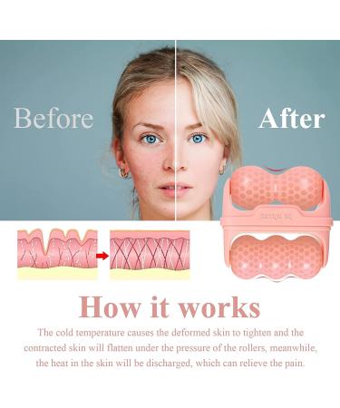Buy Ice Roller for Face & Eyes - 2 in 1 Facial Skin Care Tool | Reduce Puffiness & Relieve Migraine - Pink Carry Case Included - Buy Online on SooperMarket.com