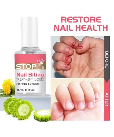 Stop Thumb Sucking & Nail Biting - Child-Friendly Nail Polish Treatment | Bitter Taste | Safe & Effective | Easy Application - 15ML - Buy Online on SooperMarket.com