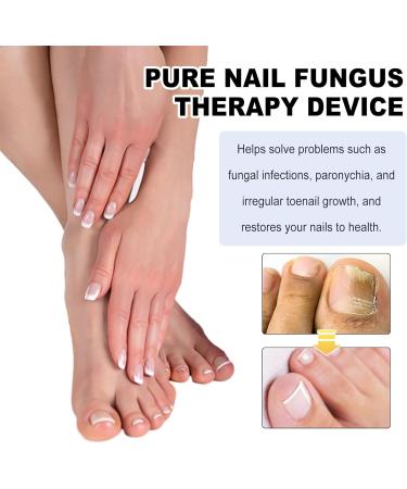 SenhE Fungus Laser Therapy Device Antibacterial Laser Equipment Light Therapy Device Fungal Nail Revolutionary High-Efficiency Light Therapy Device for Toenail Diseases  - Buy Online on SooperMarket.com