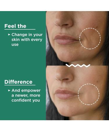 Vivo Per Lei Hyaluronic Acid Anti-Aging Cream with Retinol & Ferulic Acid - Firming Face Cream for All Skin Types - 1.7 Fl. Oz - Buy Online on SooperMarket.com