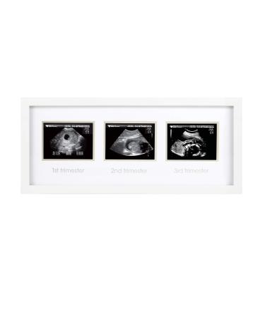 Pearhead Trimester Progression Sonogram Picture Frame, Pregnancy Milestone Keepsake Photo Frame, Gender-Neutral Baby Nursery Dcor, Mothers Day Accessory White