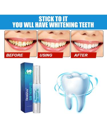 Lovilds Gums Therapy Gel Set - Instant Gum Protection Whitening & Professional Tooth Bleaching - 3 Pieces - Buy Online on SooperMarket.com