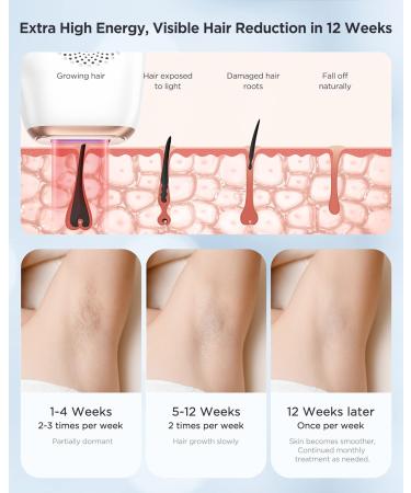 Laser Hair Removal Device with Ice Cooling Care - Permanent & Painless IPL Hair Remover for Women - 999,999 Flashes - Ideal for Armpits, Legs, Arms, Bikini Line - 1-White - Buy Online on SooperMarket.com