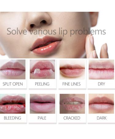 30 Pairs Lip & Eye Masks | 24K Gold Gel Collagen Pads for Moisturizing & Reducing Puffiness Dark Circles Wrinkles - Buy Online on SooperMarket.com