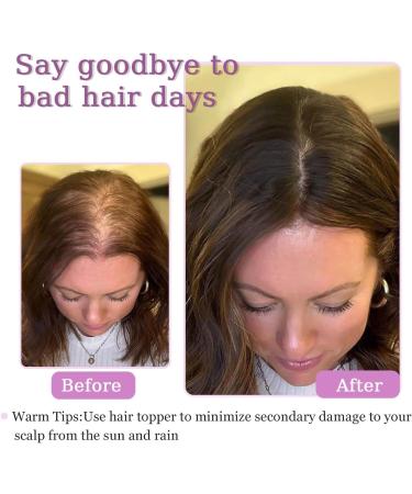 MORICHY Hair Toppers for Thinning Hair Women Real Hair Topper for Women Adding Extra Hair Volume Natural Black Clip in Hair Extensions 7inch Clip In Toppers 100% Remy Human Hair for Hair Loss 7inch-2clip 1B - Buy Online on SooperMarket.com