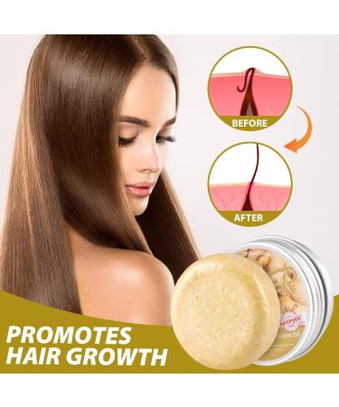Zoreni Ginger Hair Regrowth Shampoo Bar - 5 Pack | Organic Anti Hair Loss Soap | Promotes Hair Growth, Anti-dandruff & Anti-itching | 2.12 Fl Oz - Buy Online on SooperMarket.com