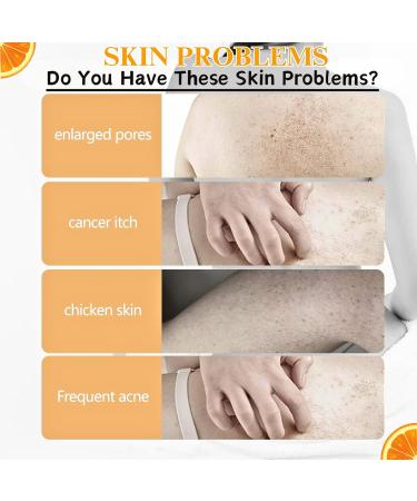 Vitamin C Cream Vitamin C Body Lotion Vitamin C Body Cream Large-capacity Body Moisturiser With Vitamin C Turmeric And Retinol Vitamin C Dry Skin Moisturiser Body Skin Care Smooth Skin 200ml - Buy Online on SooperMarket.com
