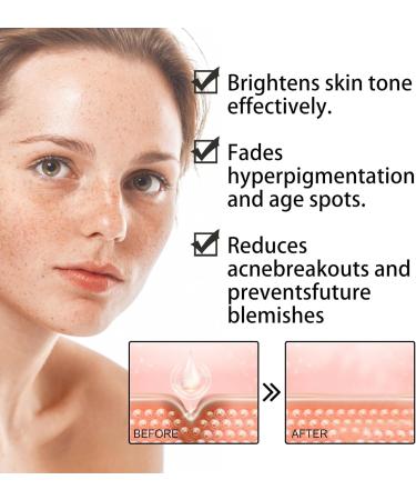 Trendyfave Facial Brightening Serum Face Moisturiser Hydrating Serum Face Serum for Women & Men Face Serum With Hyaluronic acid Squalane Shea Butter and Vitamin E Serum for Face Care - Buy Online on SooperMarket.com