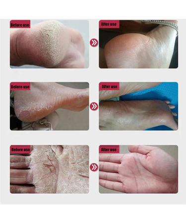 Natural Horse Oil Foot Repair Cream - Anti Cracking Skin Moisturizer for Rough Dry & Cracked Heels - 3PCS for Men & Women - Buy Online on SooperMarket.com