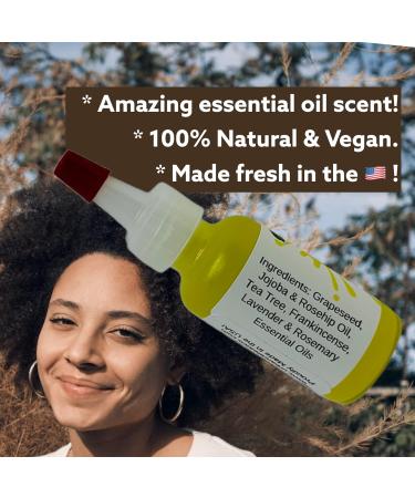 Urban ReLeaf Itchy Scalp Oil Treatment | Soothe Irritation for Braids Wigs & More | Natural Herbal Remedy Made in USA - Buy Online on SooperMarket.com