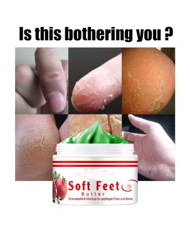 Pomegranate Hand and Foot Cream | Repair Dry Cracked Heels & Chapped Skin | Moisturizing Salve with Pomegranate Extract & Peppermint | International Shipping Available - Buy Online on SooperMarket.com
