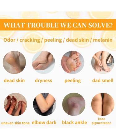Tongyend Foot Peel Spray Foot Mask Orange Oil Instant Hydrating Nourish Foot Peeling Spray Exfoliator For Cracked Rough Heels & Calluses on Feet Elbows Toes Fingers (Orange) - Buy Online on SooperMarket.com