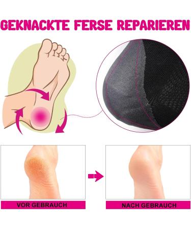 3 Pairs Moisturizing Gel Heel Socks - Soft Open Toe Socks for Dry Skin Care (Black) - International Shipping - Buy Online on SooperMarket.com