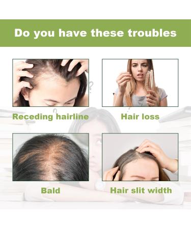 Amla Hair Oil Indian Amla Oil for Hair Amla Oil for Hair Growth Scalp Oil Nourishes Scalp Indian Hair Oil for Skin and Face Amla Essential Oil Hair Growth Oil for Women for Long Soft Strong Hair 60ml - Buy Online on SooperMarket.com