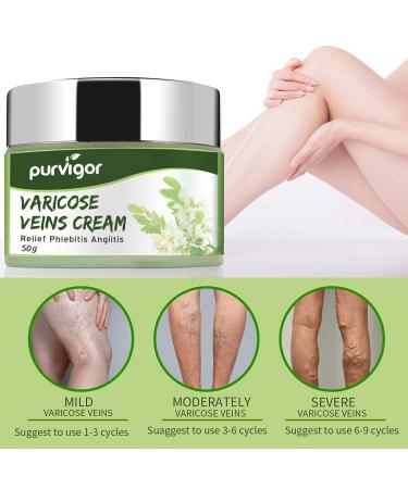 Purvigor Varicose Vein Cream - Eliminate Spider Veins & Phlebitis Angiitis on Leg, Body & Arms - Buy Online on SooperMarket.com