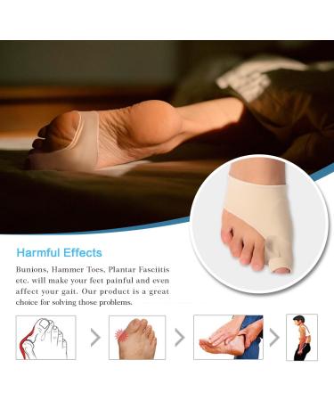 Bunion Corrector and Toe Straightener - Orthopedic Treatment for Hallux Valgus - Gel Silicone Nude - Buy Online on SooperMarket.com