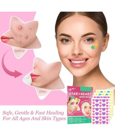 156 PCS Star-Shaped Pimple Patch Set - Hydrocolloid with Tea Tree Oil & Salicylic Acid - Waterproof Suitable for All Skin Types - Pink & Green - Buy Online on SooperMarket.com
