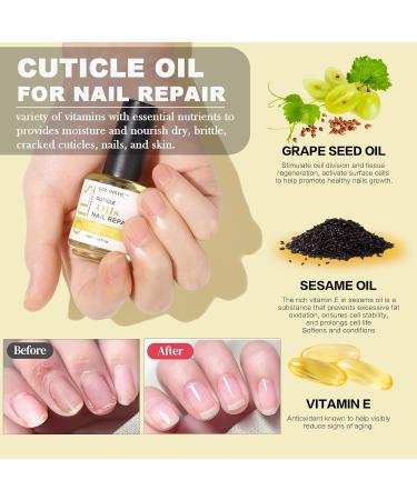 LOUINSTIC Gel Nail Polish Remover Kit - Quick 2-5 Min Removal Cuticle Oil Latex Tape & Manicure Tools for Perfect Nails - Fast International Shipping - Buy Online on SooperMarket.com