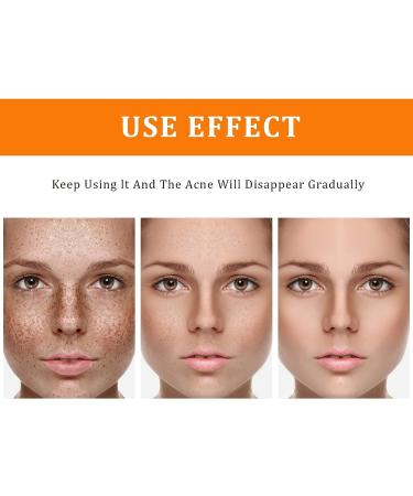 Turmeric Dark Spot Corrector Toner 4oz - Facial Toner for Acne Prone Skin - Hydrating Dark Spot Remover for Women - Hyperpigmentation Treatment for Dry Oily Skin - Buy Online on SooperMarket.com