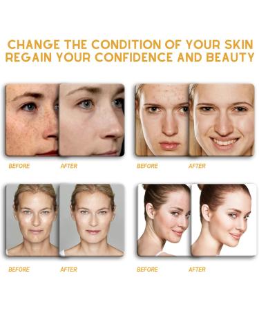 Kojic Acid Soap Kojic Soap Bar Skin Lightening Soap Bath Soap Fades Age Spots Freckles Revitalize and Moisturizing Cleansing Soap for Dark Spots Uneven Skin Tone - Buy Online on SooperMarket.com