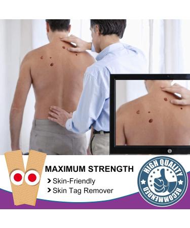 Skin Tag & Wart Remover Pads - Extra Strength, Fast & Safe Removal - 42 Count Pack - Suitable for All Skin Types - Buy Online on SooperMarket.com