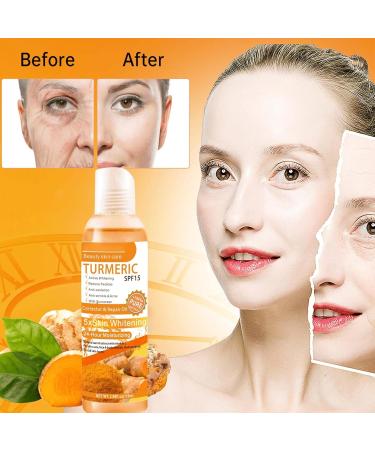 Turmeric Oil Turmeric Face Serum Dark Spot Correcting Glow Serum Reduces Age Spots Sun Spot Improve Brightening Moisturzing Body Face Oils and Serums (Turmeric Oil) - Buy Online on SooperMarket.com
