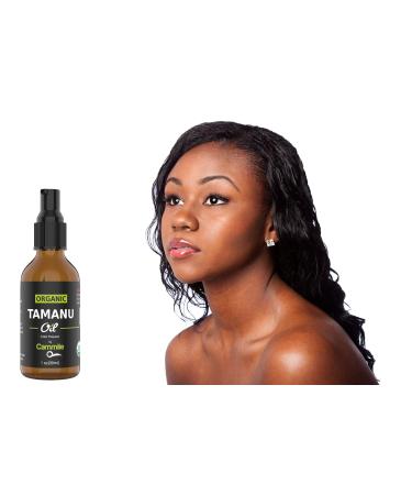 Organic Tamanu Oil - Natural Psoriasis Treatment Eczema Relief & Acne Scars - Cold Pressed & International Shipping - Buy Online on SooperMarket.com