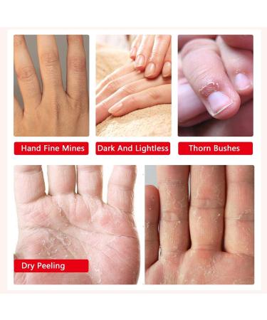 CCKULOOB Hand Mask 6 Pairs Super Hydrating Hand Mask Moisturizing Hand Mask that Enriched with Collagen Shea Butter and Vitamin-E to Revive Dry Rough and Cracked Skin (6 Lavender) 6 Packs Lavender - Buy Online on SooperMarket.com