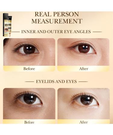 Eye Cream for Dark Circles and Puffy Eyes Brighten Instant Tightener 24K Gold Under Eye Repair Cream Hydrating Brightening Anti Aging Eye Bags Remover Wrinkle Filler Eye Serum for All Skin Types - Buy Online on SooperMarket.com