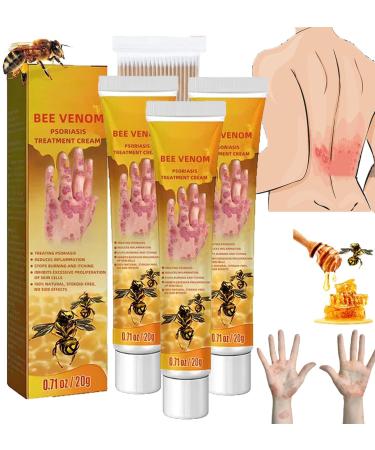 RJDJ Bee Venom Psoriasis Treatment Cream New Zealand Bee Venom Professional Psoriasis Treatment Cream Soothing and Moisturizing Psoriasis Cream for All Skin Types (4PCS)