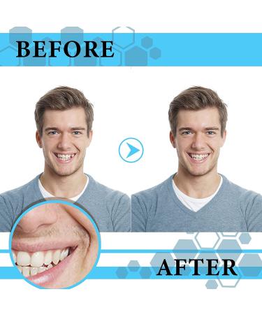 100 Pieces Resin Teeth Veneers for Halloween Cosplay, Scary Theme Party Makeup - Dental Temporary Front and Molar Posterior Teeth for Costume Filling - Buy Online on SooperMarket.com