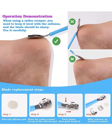 Pedicure Kits - Callus Remover for Feet  23 in 1 Professional Manicure Set Pedicure Tools Stainless Steel Foot Care  Foot File Foot Rasp Dead Skin for Women Men Home Foot Spa Kit  Blue23 - Buy Online on SooperMarket.com