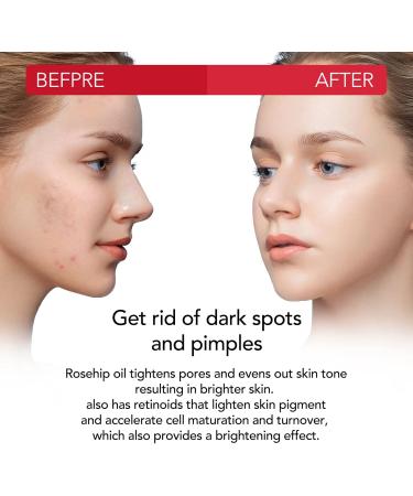 Rosehip Oil 60 ml Natural Cold Pressed Oil Moisturizing Natural Hair Care Brightens Scars Reduces Fine Face Lines Suitable for Face Hair and Body - Buy Online on SooperMarket.com