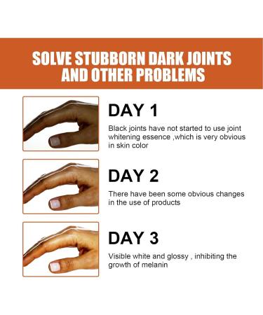 Skin Bleaching Serums | Dark Skin Permanent Whitening Lightening | Armpit Bleaching Serums for Women Supercharged Face Serums Skin Lightening Bleaching Oil Black Spot Corrector Remover for Face 2Pcs - Buy Online on SooperMarket.com