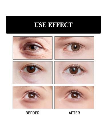 Snake Venom Peptide Firming Eye Cream 2 PCS Set - Anti-Wrinkle, Instant Face Lift, Reduce Under Eye Bags and Wrinkles - Buy Online on SooperMarket.com