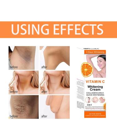 Vitamin C Armpit Whitening Cream Underarm Whitening Products For Body Whitening Skin Whitening Cream Skin Lightening Cream Melanin Removal For Underarms Armpit Knees Legs And Inner Thigh - Buy Online on SooperMarket.com