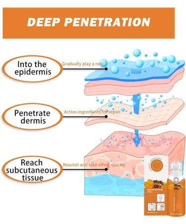 Body Therapy Bee Venom Joint & Bone Therapy Spray - Bee Venom Serum Spray Provides for Back Neck Hands Feet (1 Pcs) - Buy Online on SooperMarket.com
