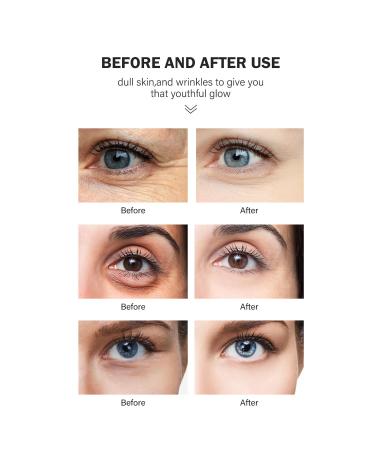 Avocado Retinol Eye Cream | Dark Circles Treatment & Anti-Aging Moisturizer | Firming Under Eye Cream for All Skin Types (15g - Buy Online on SooperMarket.com
