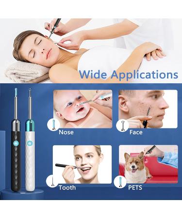Rocason White Ear Wax Removal Tool Camera - WiFi Connected 1080P HD Otoscope for Kids and Adults - Ear Cleaning Endoscopic Camera for iPhone, iPad, Android Phones - Buy Online on SooperMarket.com